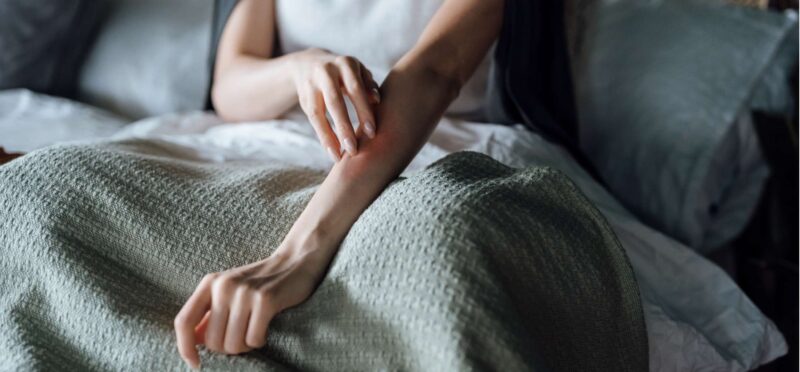 Thiếu hụt Estrogen: Các vấn đề về da trong thời kỳ mãn kinh